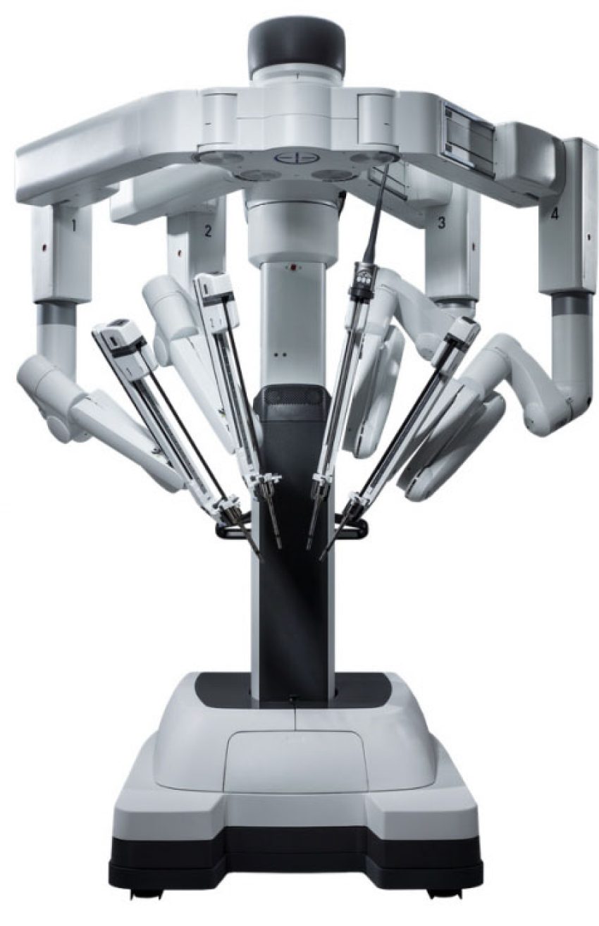Braços Robóticos
